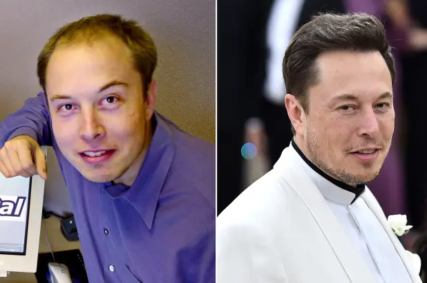 Mijëra dollarë për operacionet plastike, Elon Musk i fiksuar për t'u dukur  më i ri – Tetova Sot