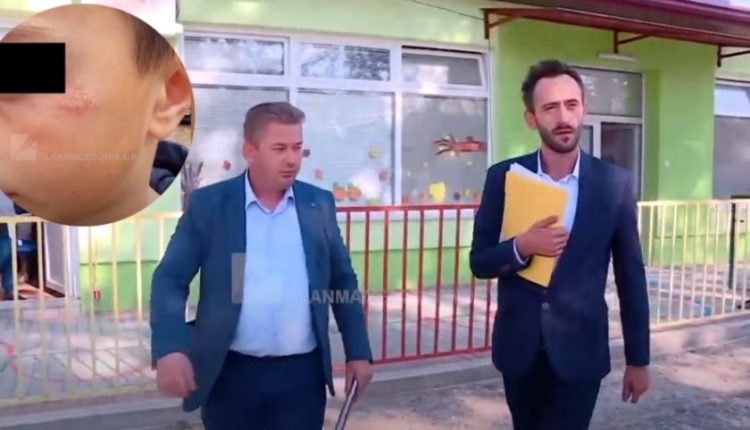 Inspektorët konstatojnë parregullësi, dënohen mësuesja dhe drejtori nga Kërçova (VIDEO)