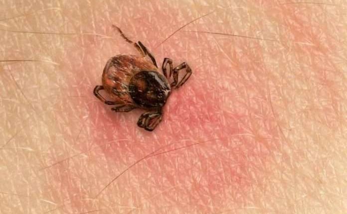 MSH: Nuk ka raste të reja të EHKK, qytetarët t ‘i përmbahen masave parandaluese