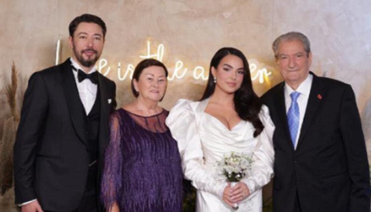 Në familjen Berisha ka rënë bomba, nusja Armina, poston foto duke hequr qimet me lazer