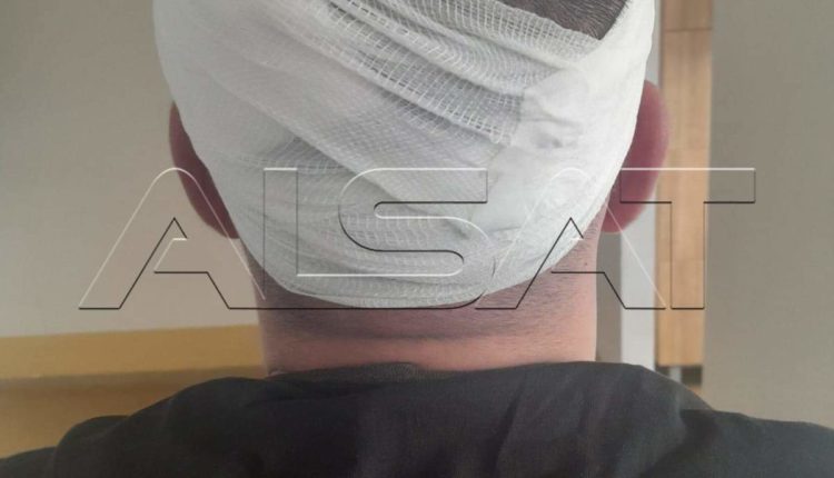 Fotografi nga dhuna ndaj të burgosurve në burgun e Idrizovës