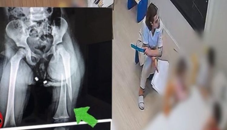 Dhunoi barbarisht 3-vjeçaren në kopshtin privat, arrestohet edukatorja