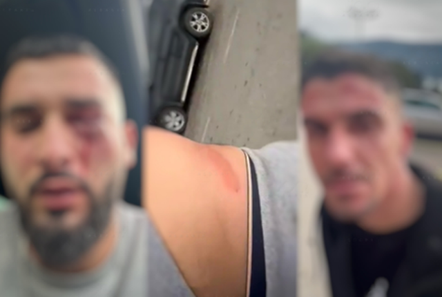 Arrestohen 5 nga 8 dhunuesit që sulmuan shqiptarët në Malin e Zi