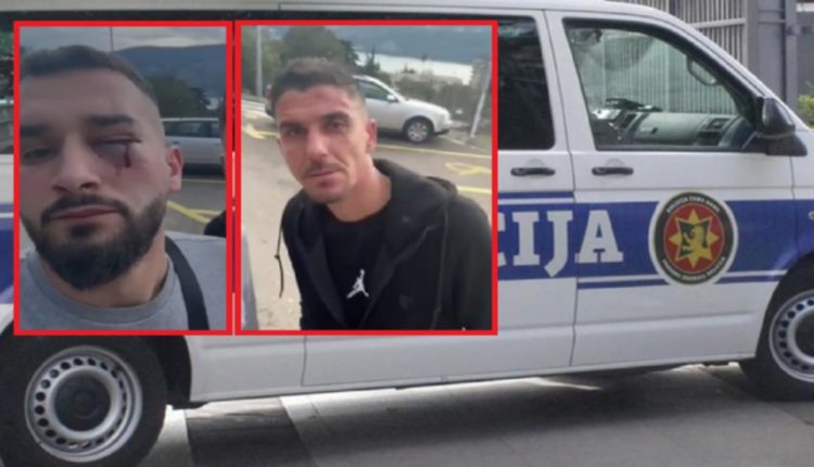 Dhuna në Mal të Zi ndaj tre shqiptarëve, Policia identifikoi tre autorë të dyshuar