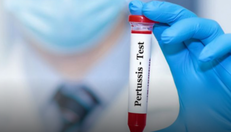 ISHP: Regjistrohen 44 raste të reja me kollën e keqe, numri i përgjithshëm i të sëmurëve është 443