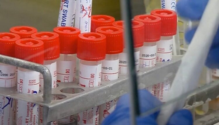 Dramë në Institutin e Shëndetit Publik! Një punëtor shkyçi siguresat e dhomave ku ruheshin reagjentët laboratorikë!