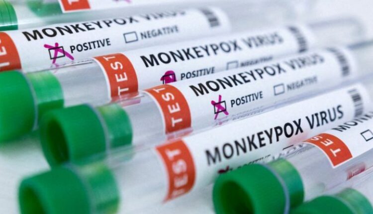 Një lloji i ri i Mpox u identifikua në Gjermani/ Autoritetet shëndetësore evropiane: Rreziku për publikun është i ulët