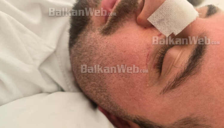 Dhunuan efektivin e Bashkiakes, Policia i arrestoi, Prokuroria e Vlorës urdhëron lirimin e babë e bir