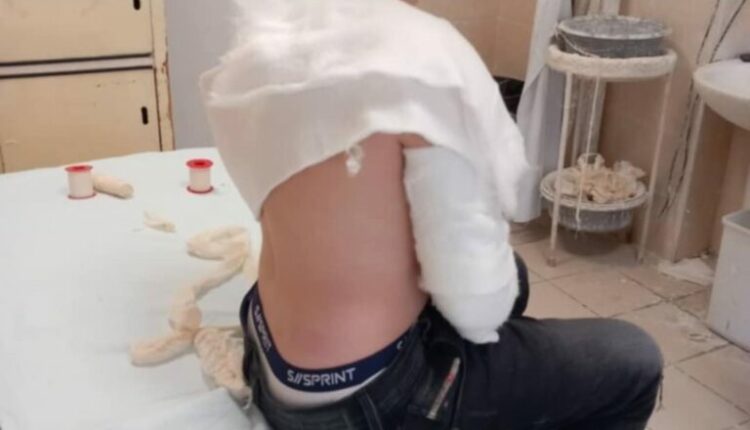 Sfidat në Tiktok/ Flet babai i një të lënduari: Si më përfundoi djali në spital