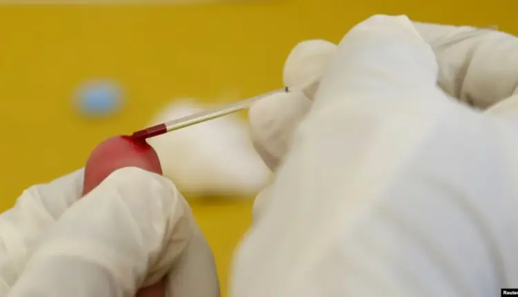 HIV në rritje në Kosovë, 10 raste të reja në pesë muaj