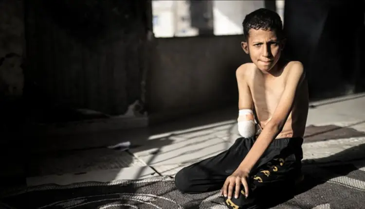 Ahmedi nga Gaza, i cili u sulmua nga Izraeli ndërsa luante futboll, dëshiron t’i kthehet dora