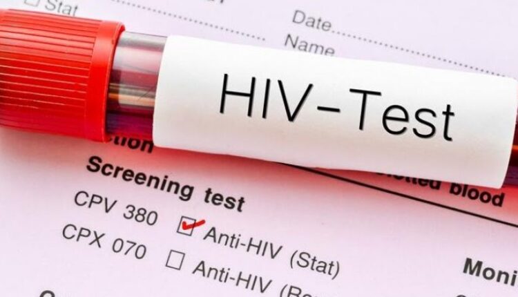 RMV, tre raste të reja me HIV dhe AIDS të regjistruara në qershor, një person ka vdekur