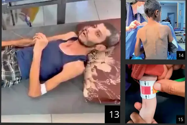 “Uria në çdo cep”, pamjet nga brenda spitaleve të Gazës që po tmerrojnë botën