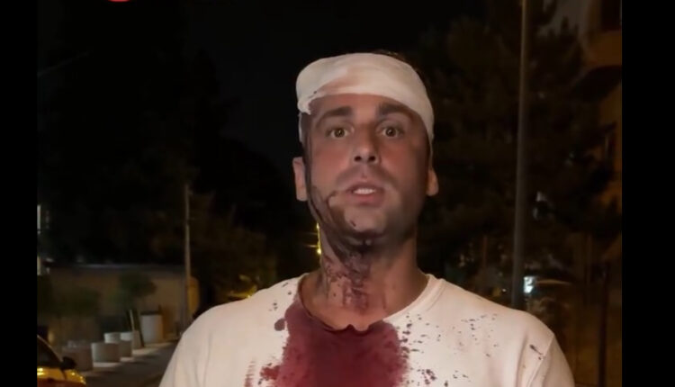 Protesta me tensione në Serbi – deputet rrihet brutalisht nga disa persona të maskuar
