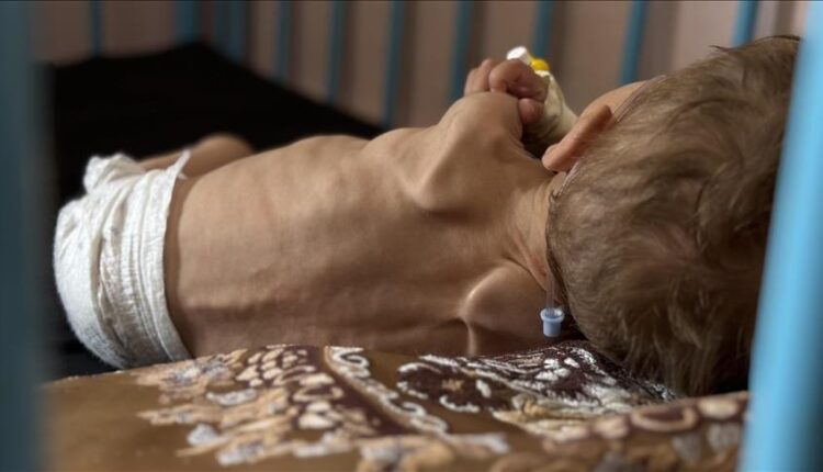 Rritet në 300 numri i të vdekurve nga uria në Rripin e Gazës, 117 prej tyre janë fëmijë