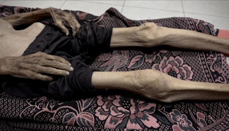 Shkon në mbi 260 numri i të vdekurve nga uria në Gaza