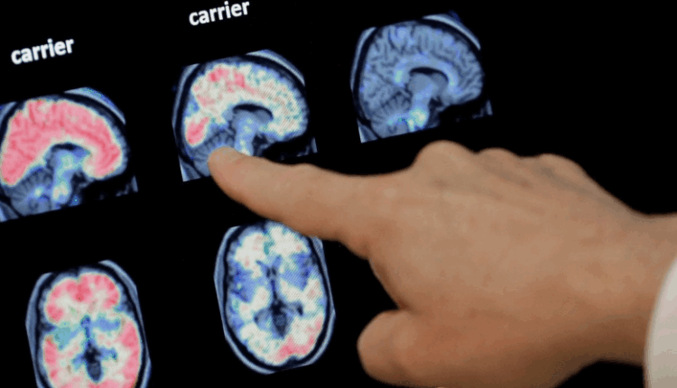 Alarmohet India: Rriten rastet vdekjeprurëse të amebës që “han trurin”