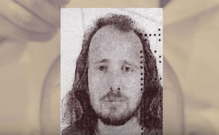 Shkoi në Turqi për të mbjellë flokët, vdes pas transplantit 36-vjeçari shqiptar