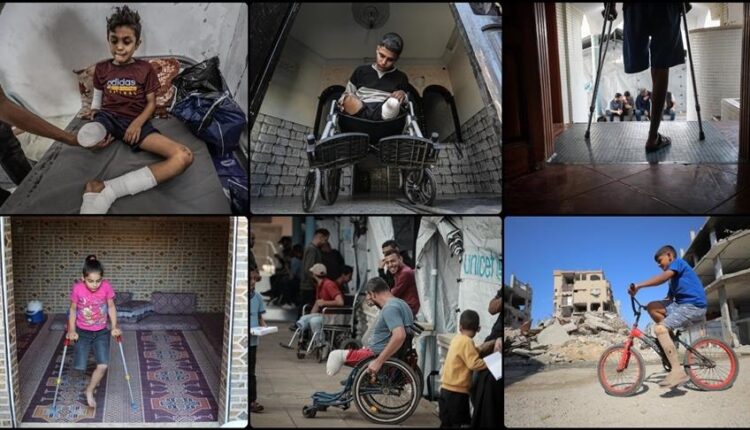 Ministria e Shëndetësisë në Gaza: 6.000 persona të amputuar kanë nevojë për rehabilitim urgjent