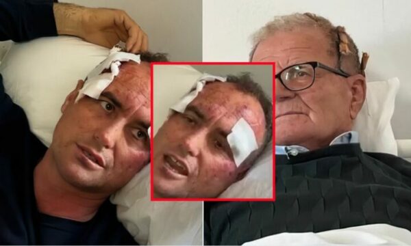  Pse i bëre like   mërgimtari dhe babai i tij janë rrahur nga fqinji polic në Fier  arsye facebook u i motrës