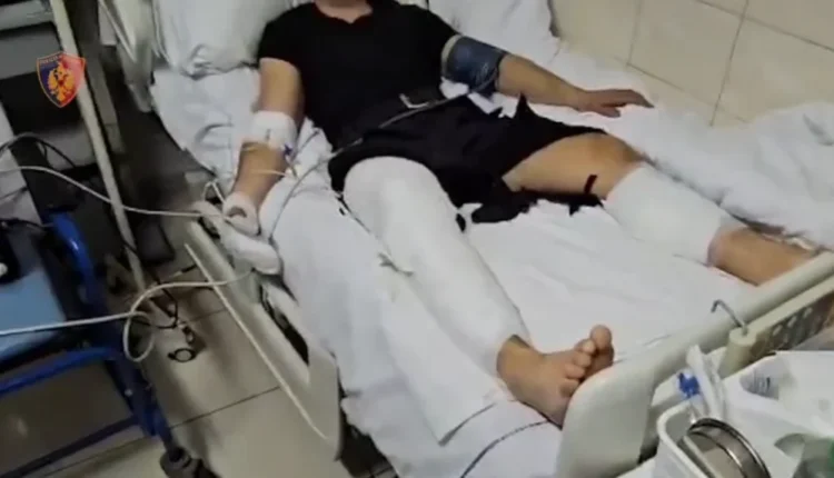 16 efektivë të plagosur, Ministrja e Brendshme shkon në spital: Kanë djegie të konsiderueshme, nuk ishte protestë, por tentativë vrasjeje