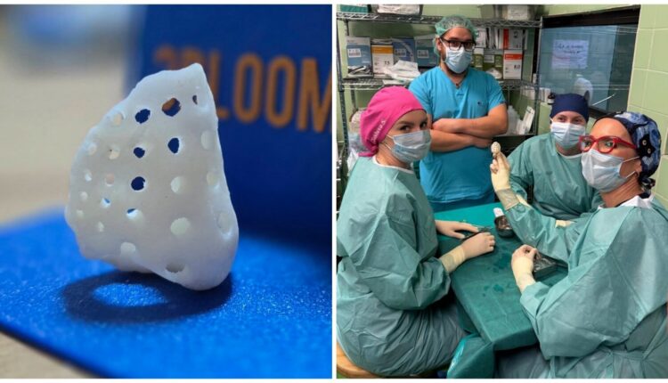 Për herë të parë në Maqedoni dhe rajon: Ndërhyrje kirurgjikale me një implant hunde të printuar në 3D