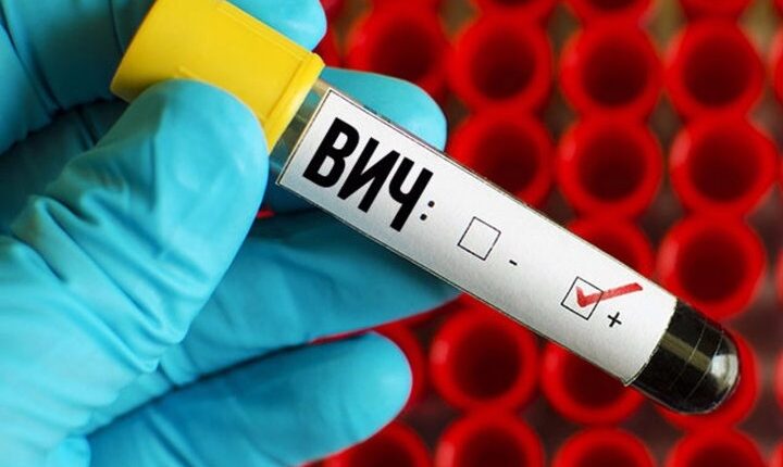 Rusia zhvillon vaksinën kundër HIV-it