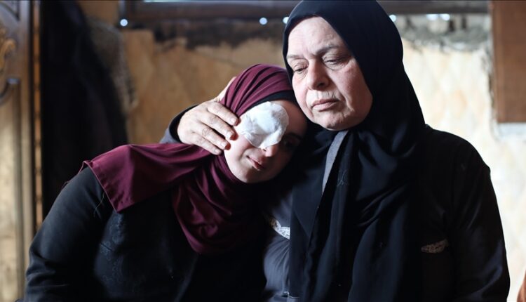 Humbi syrin në sulmin izraelit, e reja nga Gaza vazhdon të pikturojë pavarësisht aftësisë së kufizuar