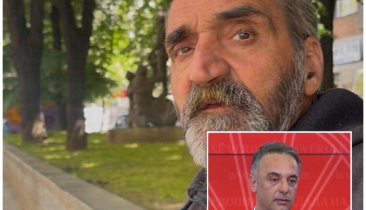 Ministri Aliu shpëton nga amputimi një të pastrehë pa sigurim shëndetësor