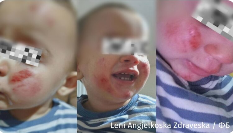 “Ma morën fëmijën nga krahët, me forcat e fundit e shpëtova”: Nëna dëshmon për tmerrin me dy qen në rrethinën e Kërçovës