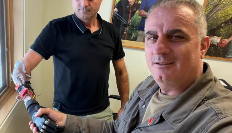 Emocionuese: Pas 28-vjetësh invalidi i luftës që e humbi dorën kur ishte 20-vjeçar, vendos dorë teknike