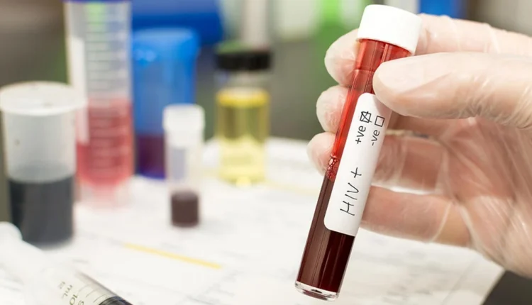 Në korrik janë regjistruar 11 raste të reja me HIV/AIDS, më i riu është 20-vjeç