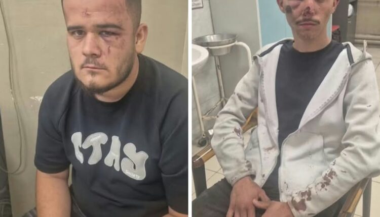 Policia e Toshkovskit i “zhdëp” në dru të rinjtë shqiptarë, vredistët heshtin!