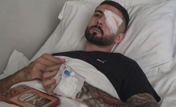 Momenti kur Erjon Vishkulli qëllohet me plumb gome në sy, ulërimat dhe rrëzimi i 28-vjeçarit (VIDEO)