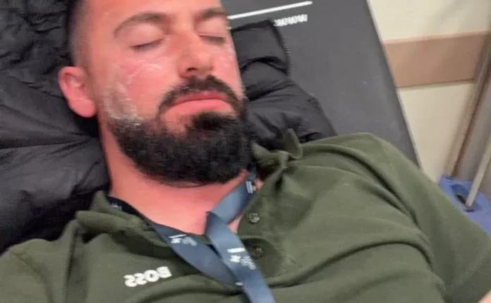 Edhe një gazetar i lënduar, thotë se u godit nga policia me gaz lotësjellës edhe pse u identifikua